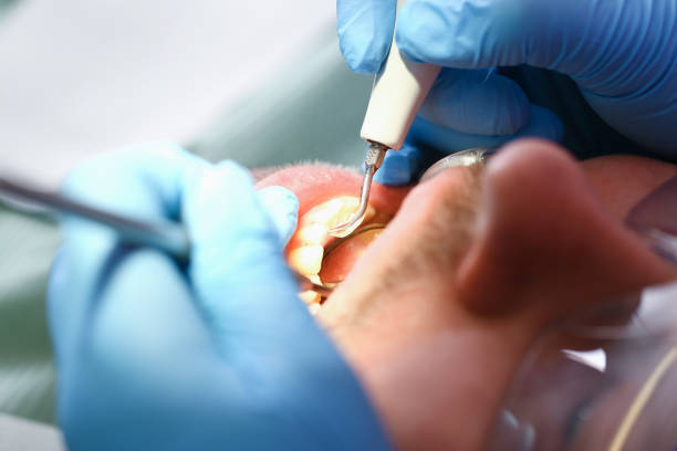 Best Emergency Dentist for Knocked-Out Tooth in Keno, OR